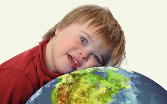 Dünya'ya 46+1 Penceresinden Bakıyorum/Down Sendromu